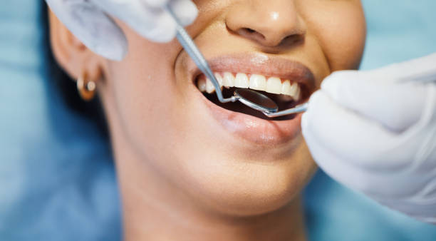 Best Urgent Care for Lost Fillings or Crowns in Shavano Park, TX